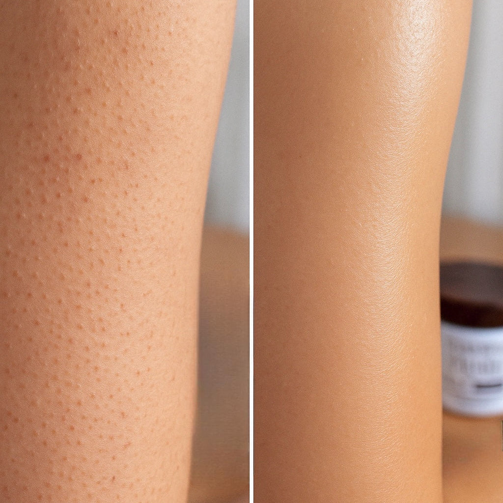 Before & After