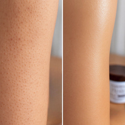 Before & After